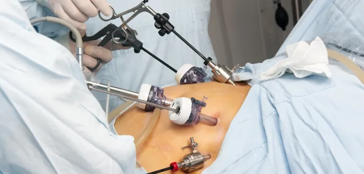 Lifestyle Changes After Weight Loss Surgery in Ahmedabad