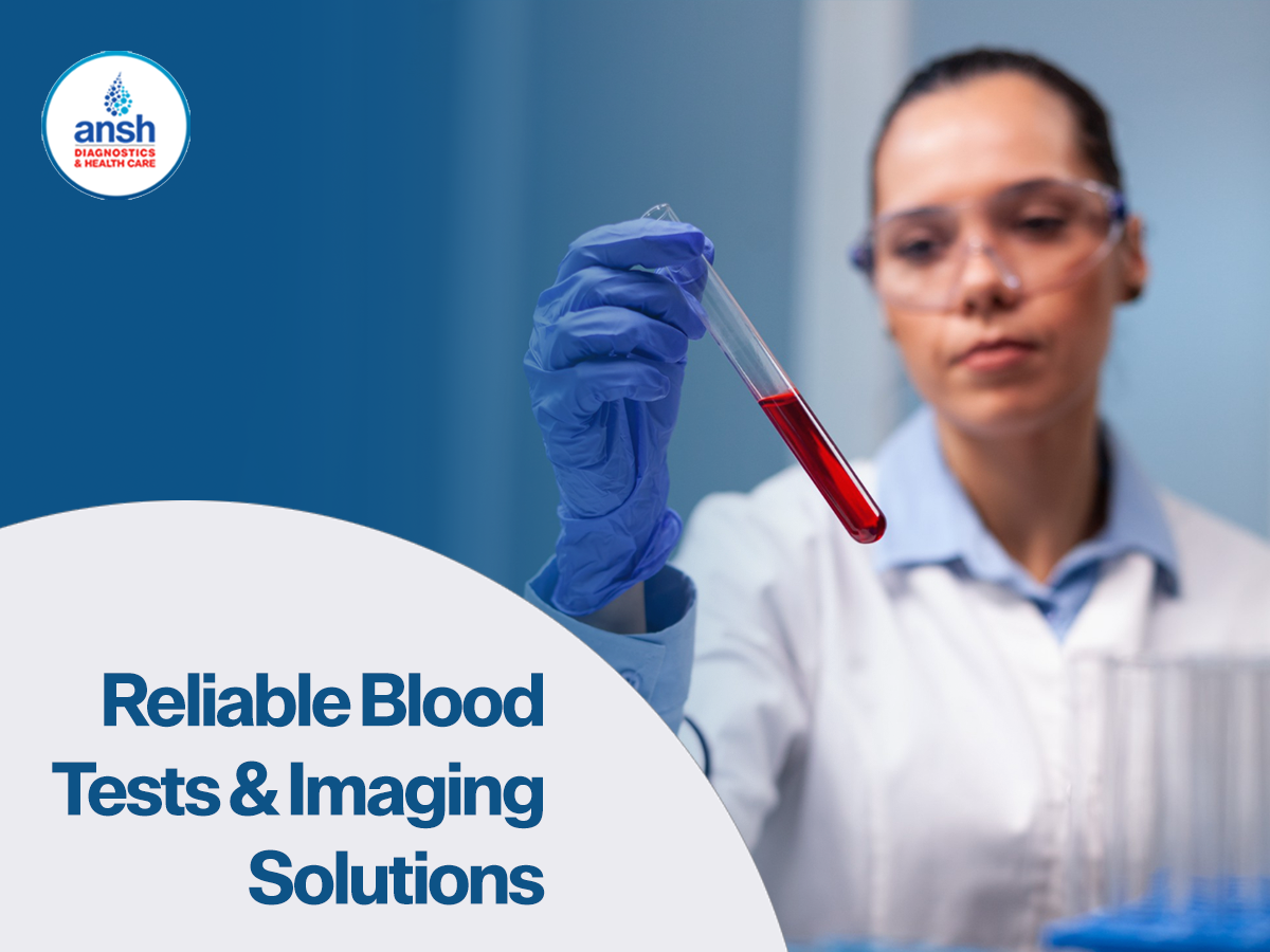 hormonal blood tests in ghaziabad: Reliable Diagnostics for Accurate Health Insights Featured Image