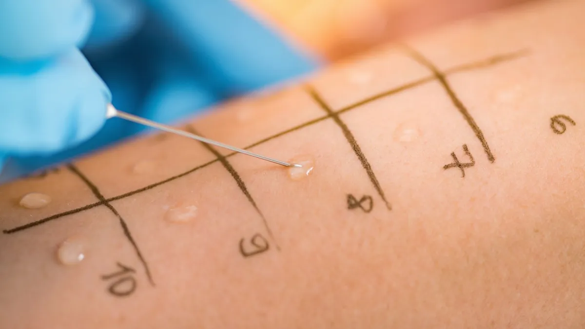 Allergy Specialist in Dubai for Accurate Diagnosis and Care