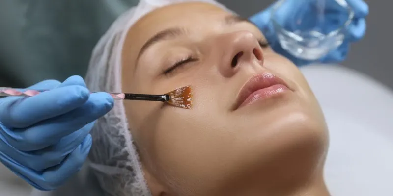 Chemical Peel for Sun-Damaged Skin: What You Should Know