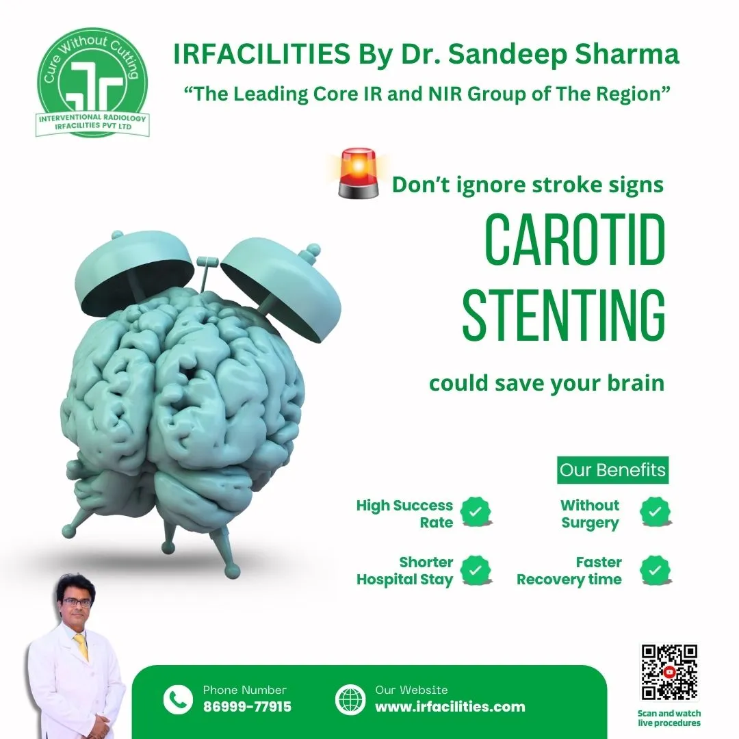 Carotid Angioplasty in India is a Life-Saving Method for a Better the Flow of Blood