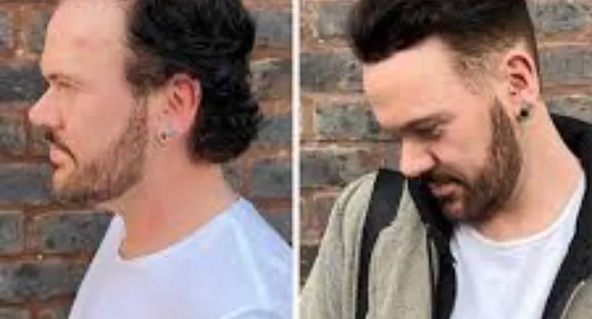 Redefining Modern Hair Solutions with Hollywood Lace