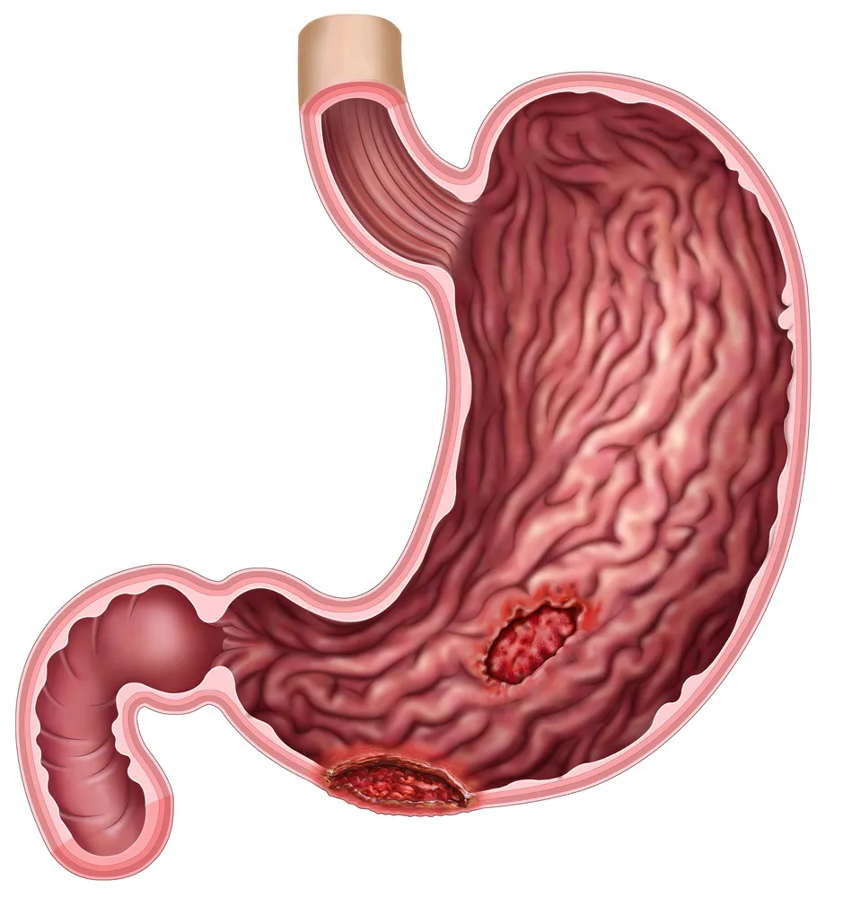 Digestive Symptoms That May Need Attention of a Stomach Doctor Dubai